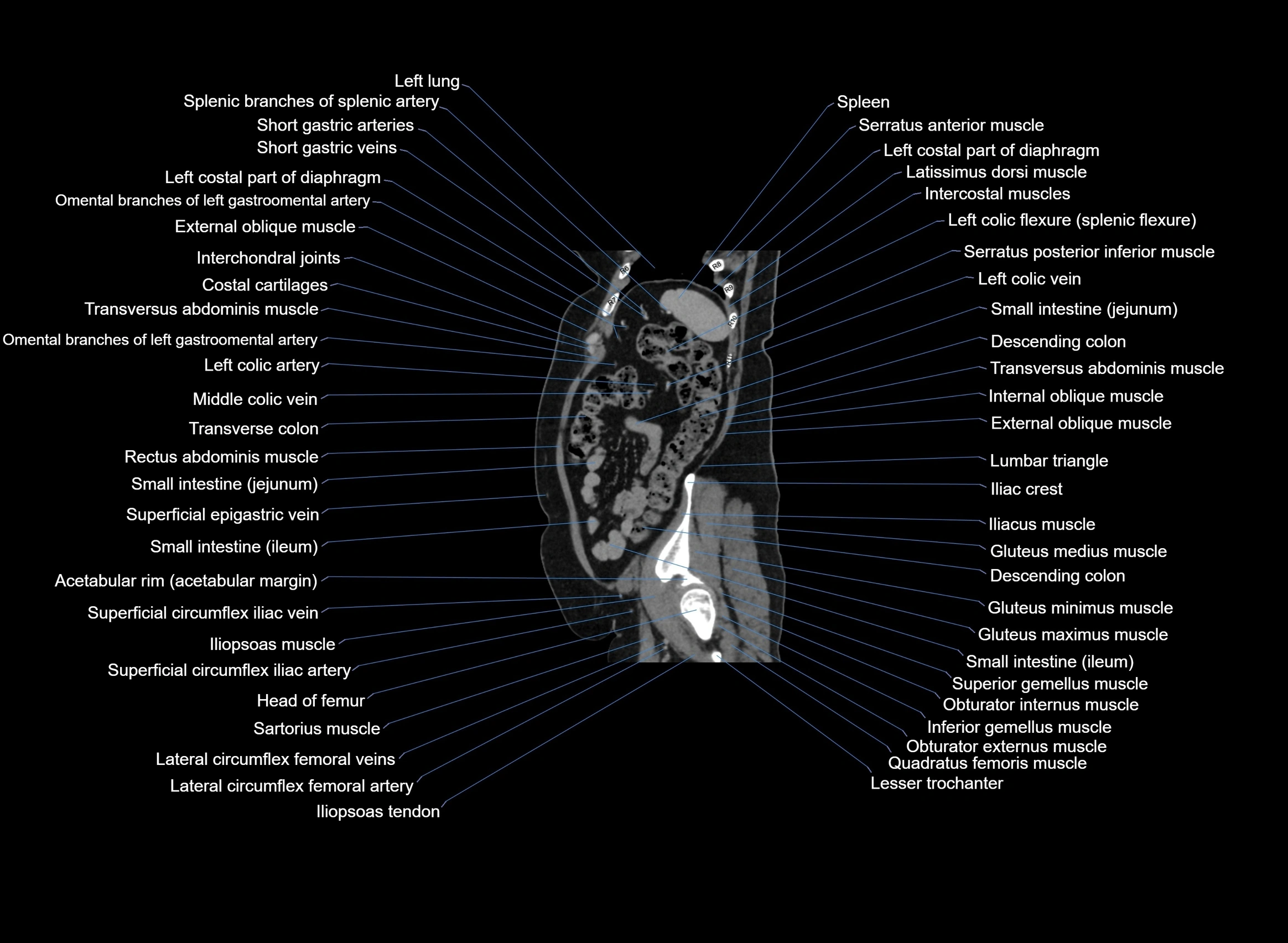 CT Abdomen sagittal cross sectional anatomy labelled radiology image -00024.webp